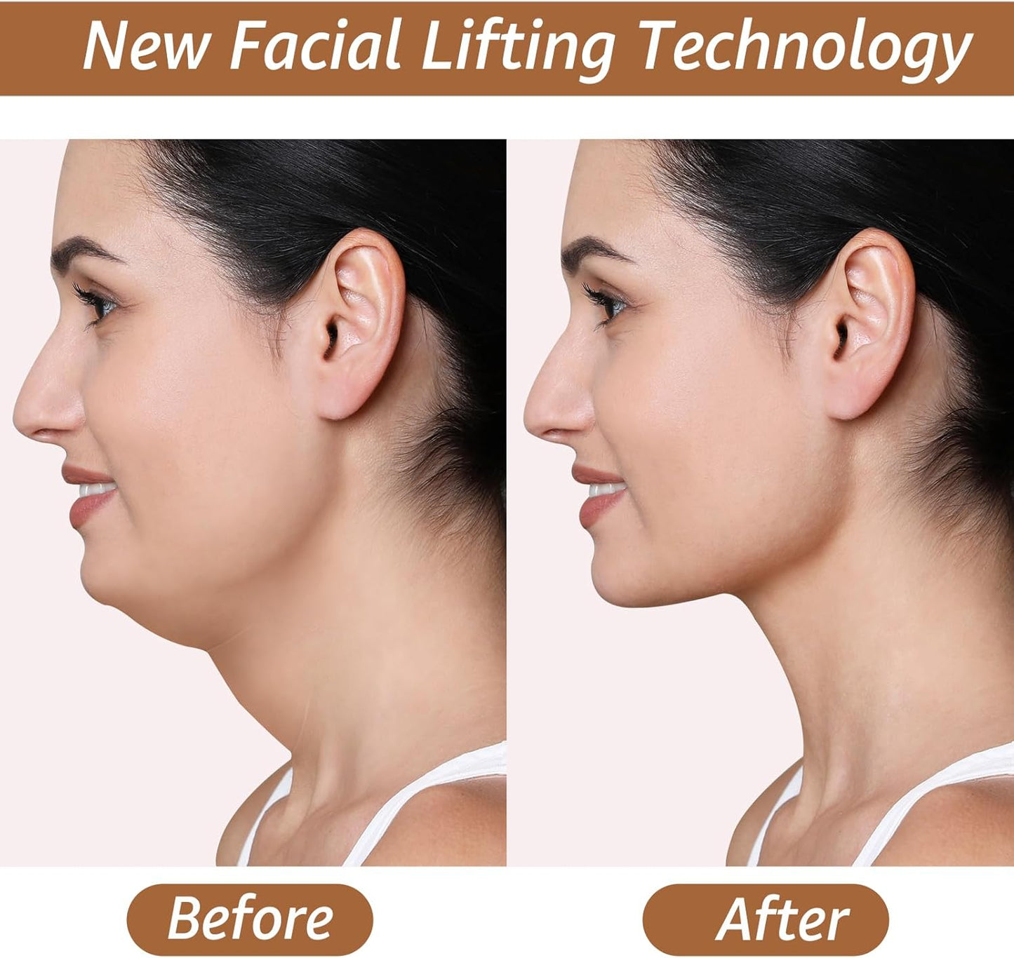 Halneit Chin band with mouth patch function - food-grade silicone V-shaped lift patch, suitable for sleep, double chin reduction, jawline and neck lift, poppy cloud Gane face effect