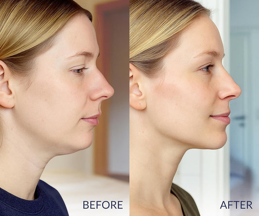 Halneit V Line Lifting Collagen Face Mask - Double Chin Strap for Women - Jawline Shaper Face Lift Tape - Neck Lift Collagen Mask - Chin Strap for Sleeping - Hyaluronic Acid, Aloe Vera, Cica 10PC